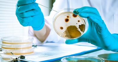 Analyse de moisissures