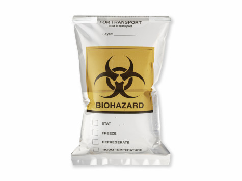 Solución impermeable y estanca