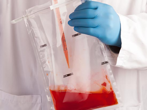 Homogenizer bag designed to facilitate aliquot sampling